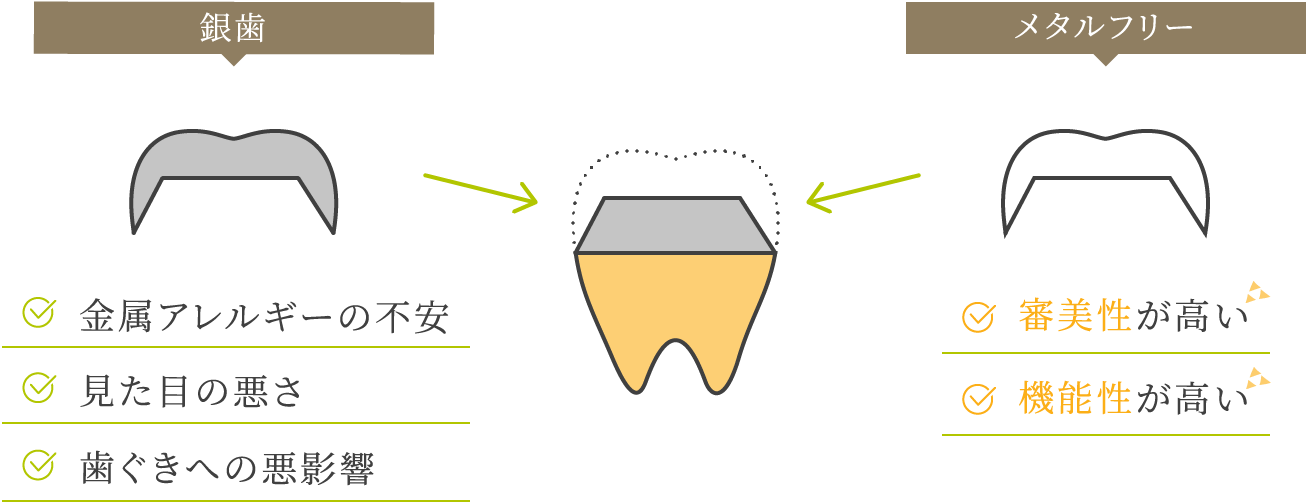 銀歯金属アレルギーの不安見た目の悪さ歯ぐきへの悪影響メタルフリー審美性が高い機能性が高い